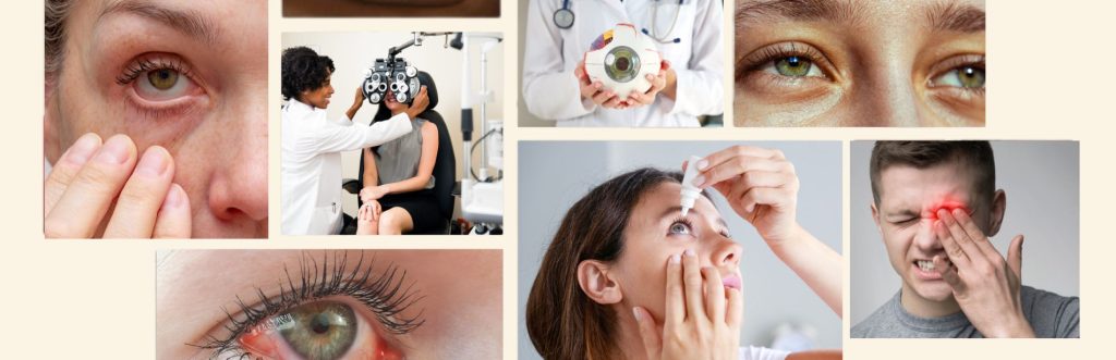 Dry Eyes and Eye Allergies
