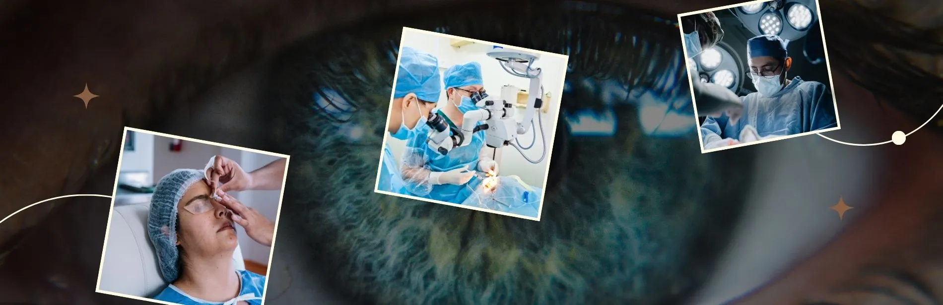 Choosing a Lens for Cataract Surgery: 5 Factors to Know